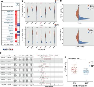 ASF1B Serves as a Potential Therapeutic Target by Influencing Cell Cycle and Proliferation in Hepatocellular Carcinoma